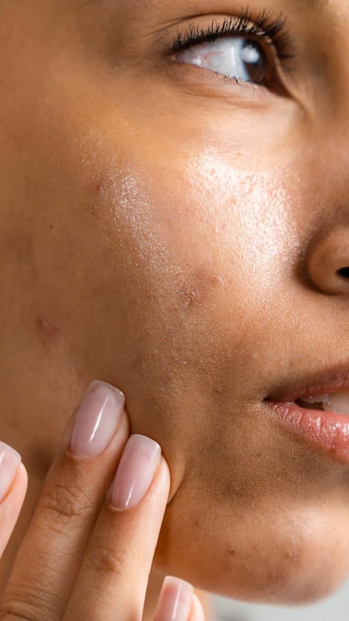 Dull & Uneven Texture