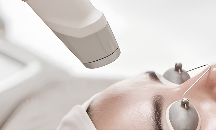 LASER REJUVENATION